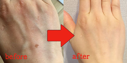 顔のシミを薄くする方法「ロスミンローヤル」の口コミって?