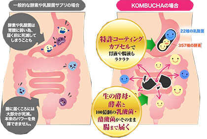 ヤセ菌サプリ「KOMBUCHA生サプリメント」の効果と口コミは?