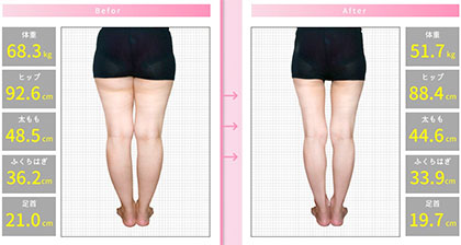 足のむくみ用サプリ「セルライトスリム」の口コミって?