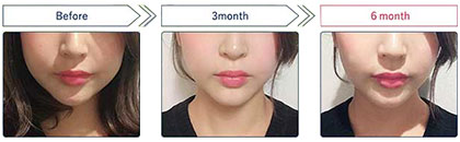 ナイトクリームのおすすめ!モテ肌と小顔が手に入る「おやすみ中のご褒美」の口コミ・効果って?