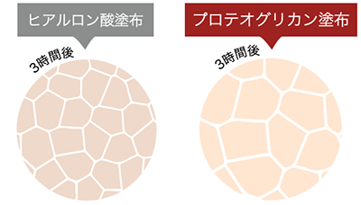 プロテオグリカン