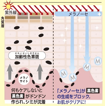 メラノサイトでチロシンが黒色素