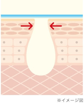 毛穴改善!美容液・パック・クレンジング・洗顔の4つケアができる「Serum Dew(セラムデュー)AAクレンズ」のリアルな口コミって?