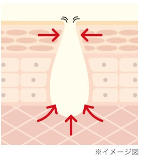毛穴改善!美容液・パック・クレンジング・洗顔の4つケアができる「Serum Dew(セラムデュー)AAクレンズ」のリアルな口コミって?