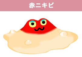 赤くて炎症を起こしたニキビ