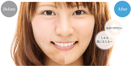 <ニキビ跡が消える>パルクレール美容液って本当に効果あるの?口コミ・成分を徹底検証♪