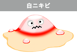 白くて芯があるニキビ