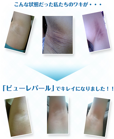 ピューレパールの口コミ