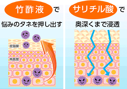 竹酢液で足のつめの足裏のゴワゴワまでケア