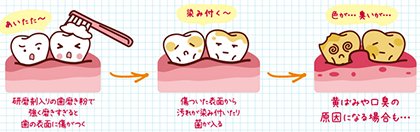 歯の黄ばみの原因