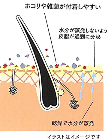 乾燥が原因でワキガの臭いが発生