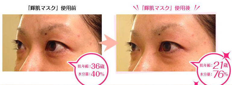 オールインワンマスク クラシエ