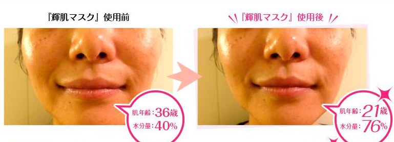 オールインワンマスク 肌美精