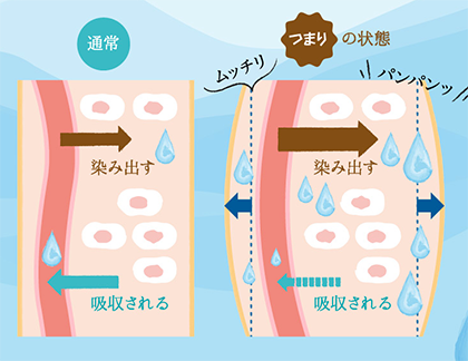 体のぜい肉ではなく、むくみが原因かも!