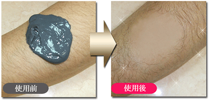 除毛剤人気「薬用ラグジュアリーブラックエピ プレミアム」