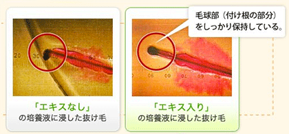 女の抜け毛予防