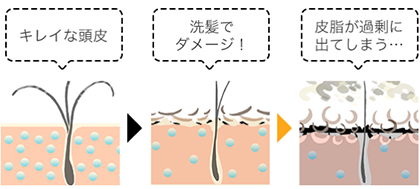 髪のべたつき解消