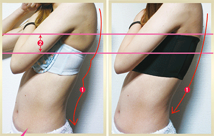 脇肉・背肉の逆流補正