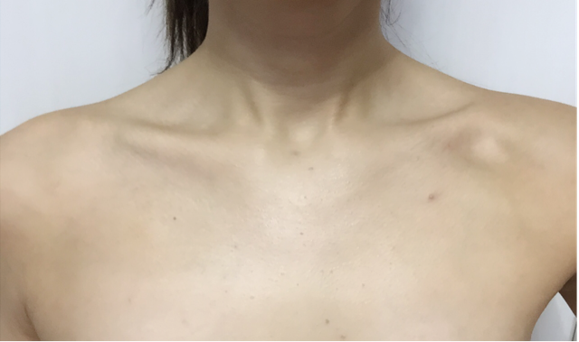 ニキビケア用 ”emione”の化粧水 あいにゃん