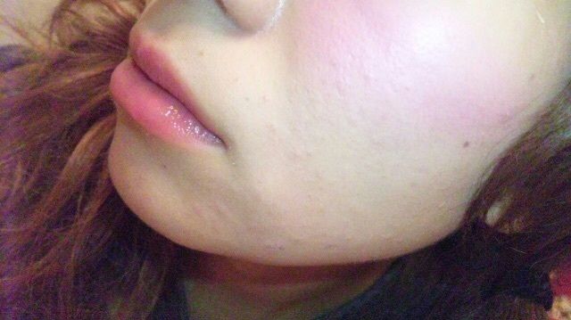 ニキビケア用 ”emione”の化粧水 あいにゃん