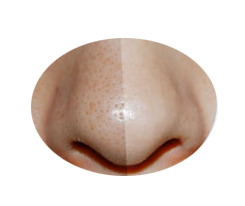 みちょっぱのクリーミュー　口コミ