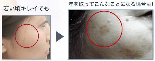 エルシーノ 口コミ