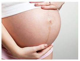 正中線とは?産後のお腹の黒ずみ
