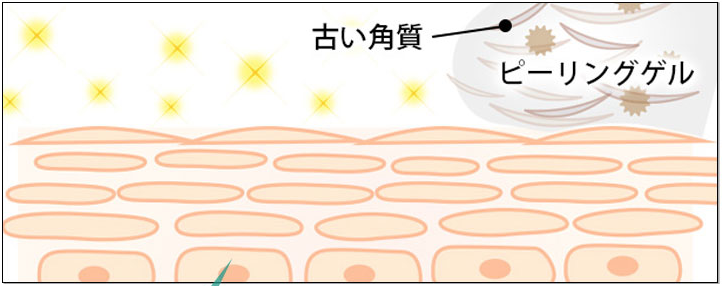 ニキビターンオーバー　ピーリング