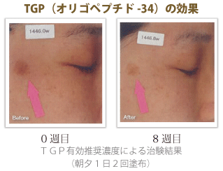 先進ペプチド「TGP」