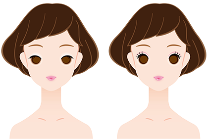 綺麗なくっきり二重