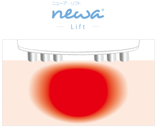 BEAUTELLIGENCE(ビューテリジェンス) newaリフト