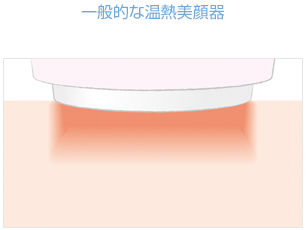 BEAUTELLIGENCE(ビューテリジェンス) newaリフト