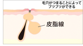 ピュアルピエ(旧:ピュアルテ)