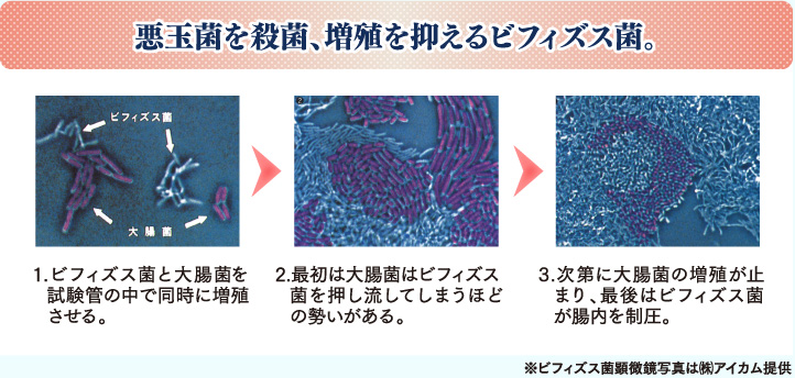 特許取得のビフィズス菌「ビフィコロン」