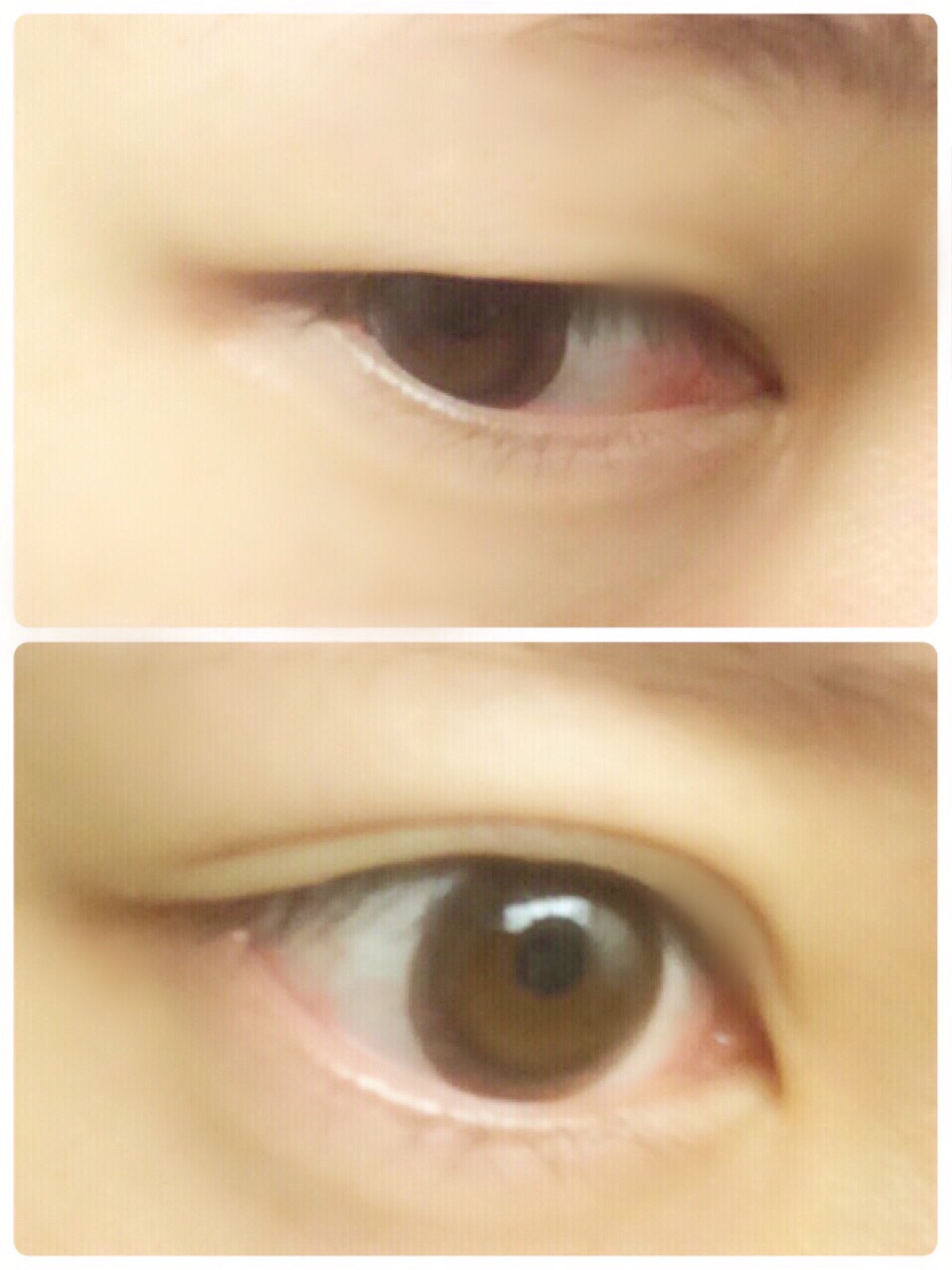 ナイトアイボーテ 口コミ