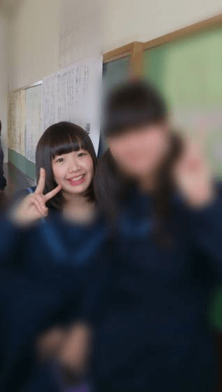 きりまる ナイトアイボーテ片目だけ二重 整形