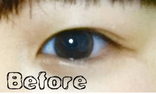 きりまる ナイトアイボーテ夜用アイプチ おすすめ平行二重にする方法アイプチとアイテープ