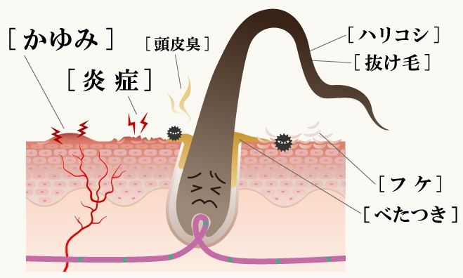 オルタニカ スカルプエッセンス