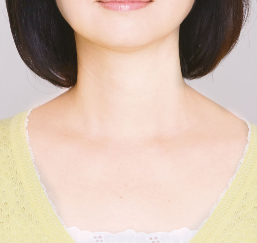 薬用美酒爛（ビシュラン）