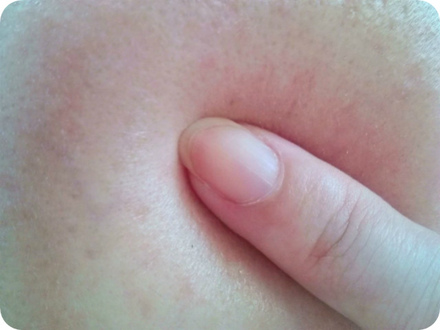 エニシングホワイト プレミアムモイスチャー