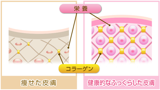 EYE KIRARA アイキララ