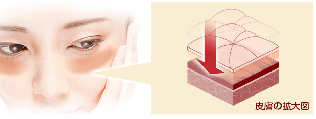 EYE KIRARA アイキララ