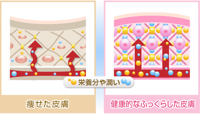 EYE KIRARA アイキララ