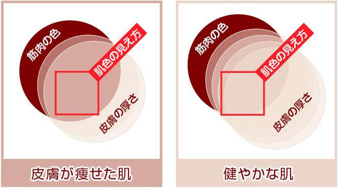 EYE KIRARA アイキララ