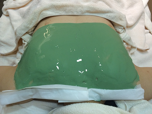 シーズラボの背中ニキビ体験記