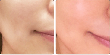 モイストエンジェルスキンエッセンス 鈴木絢子