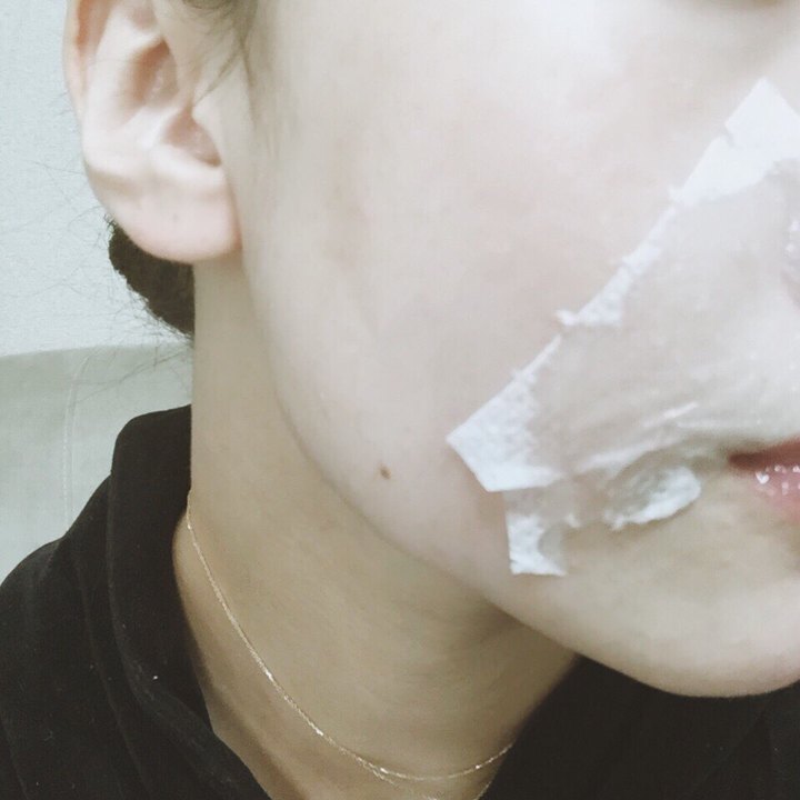 モイストエンジェルスキンエッセンス 孫きょう