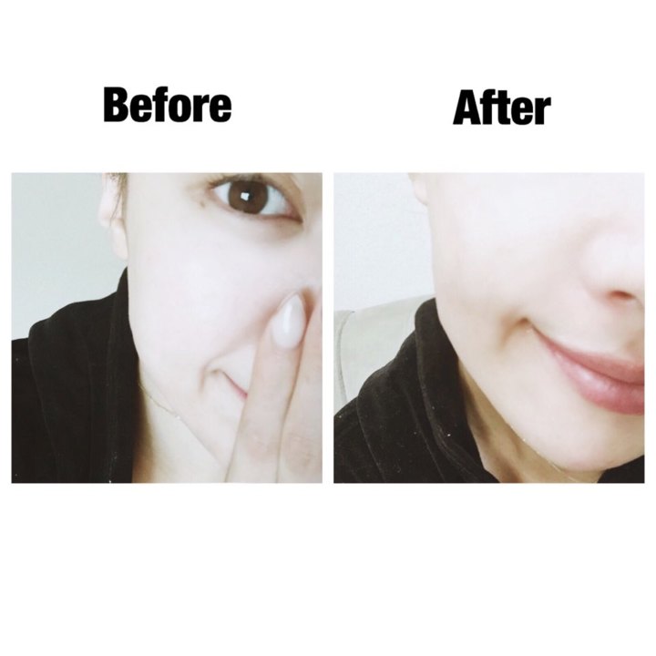 モイストエンジェルスキンエッセンス 孫きょう