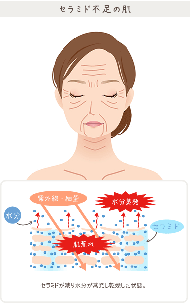 ピュアセラ 口コミ