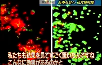 NHKの報道特集「長寿社会へ 研究最前線」でもまた、水素が取り上げられていました。